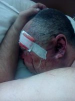 На Хустщині двоє чоловіків жорстоко побили односельчанина, — соцмережі (+ФОТО)