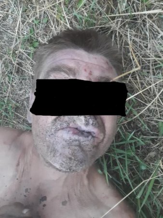 В урочищі на Виноградівщині виявили труп чоловіка (ФОТО 18+)