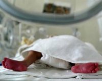 Померли сіамські близнючки, які народились в Чернівцях