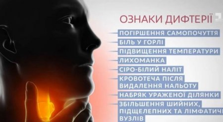 Як розпізнати симптоми дифтерії